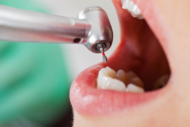 Best Urgent Tooth Repair  in Mohave Valley, AZ